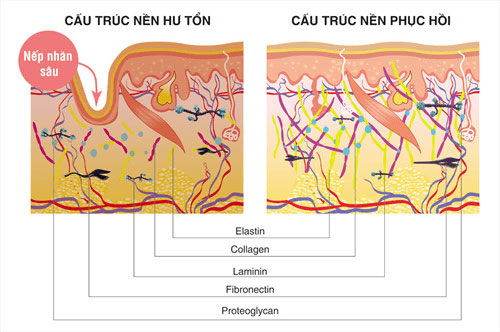 cấu-trúc-da-bị-nếp-nhăn-sâu