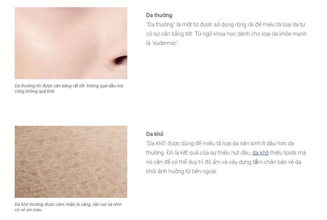 da thường da khô