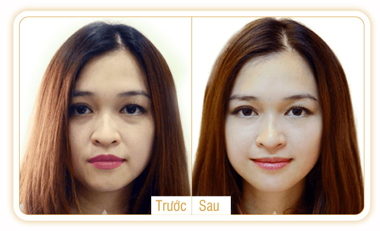 trước-sau-khi-sử-dụng-máy-rửa-mặt-lumispa