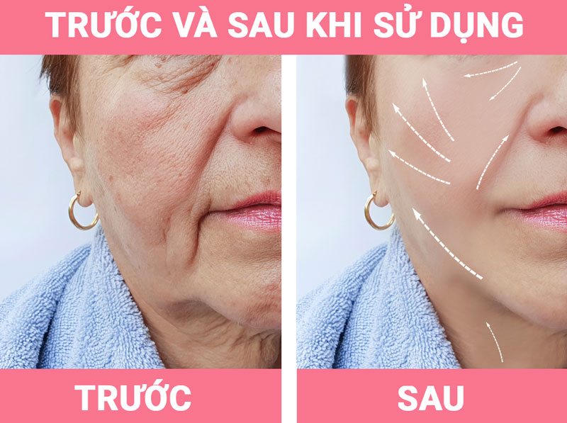 tác-dụng-của-tru-face-trước-và-sau-khi-sử-dụng
